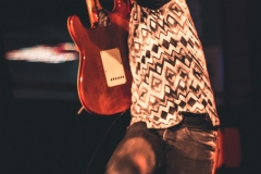 Trigger Thumb
