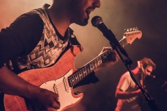 Trigger Thumb
