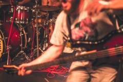 Trigger Thumb