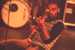 Trigger Thumb